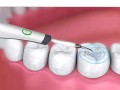 pol_pl_Skaler-dentystyczny-ultradzwiekowy-do-kamienia-2871_7.jpg
