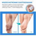 Elektryczny pilnik do pięt USB – frezarka do stóp, tarka do usuwania zrogowaciałego naskórka